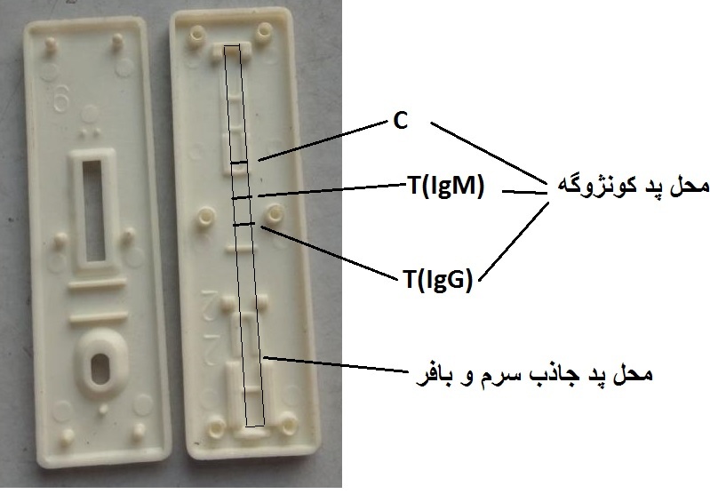 رپید تست شناسایی IgMو IgG کووید19(عامل بیماری کرونا)