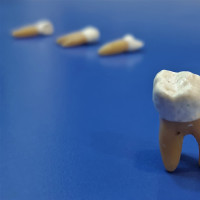 مدل و مولاژ دهان و دندان