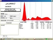دانسیتومتر